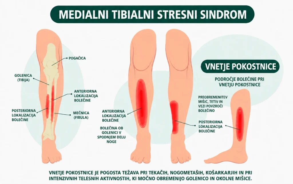 Anatomija vnetja pokostnice